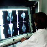 Screening oncologici,prevenzione per la lotta ai tumori