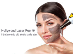 SpaMarine - Carbon Laser Peel